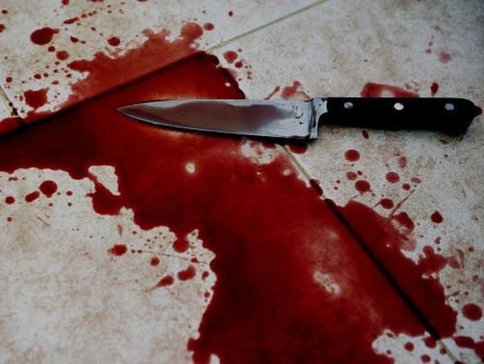 Man Chops Off His Friend’s Ear In Lagos 1 The Lagos State Police command has verified that a certain Bashiru Ahmed has been arrested for reportedly chopping off a friend's ear. The Lagos State Police command has verified that a certain Bashiru Ahmed has been arrested for reportedly chopping off a friend's ear. KNIFE BLOOD