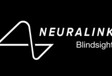 Elon Musk’s brain chip to help blind people see